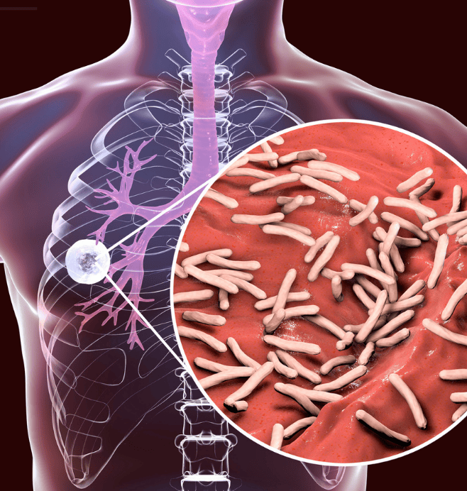 Grupo de Investigación en Tuberculosis